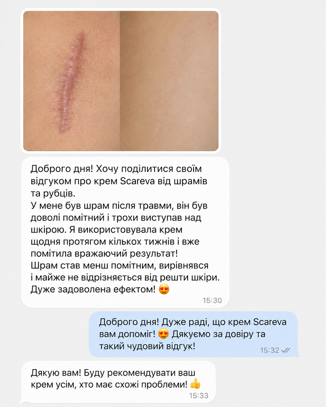 scareva_lp_review_carousel_01_v1